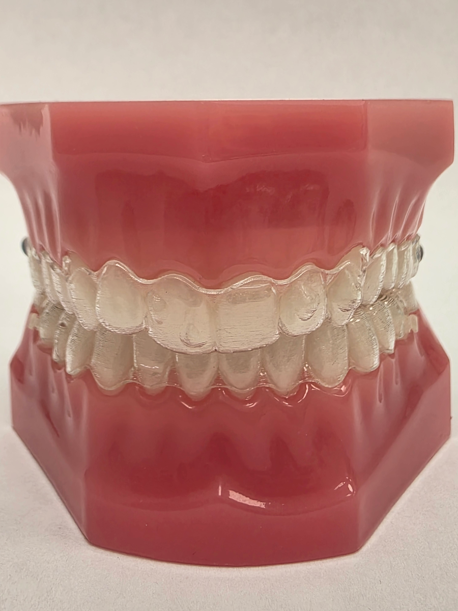 Aparat ortodontyczny - nakładki Invisalign